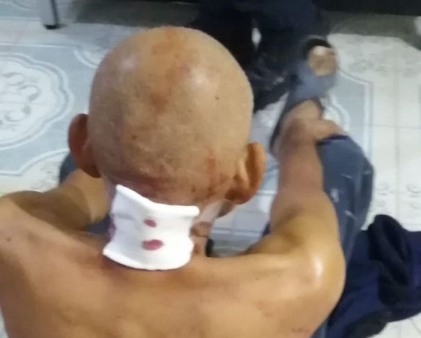 Agreden con arma blanca a periodista yucateco